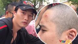 Tai nạn trên phim trường 'Quỳnh Búp Bê': Thái tử Thiên Thai bắn nhầm quay phim