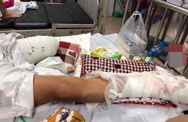 Phú Thọ: Nam thanh niên bị cắt 1 chân do bị truy sát-2