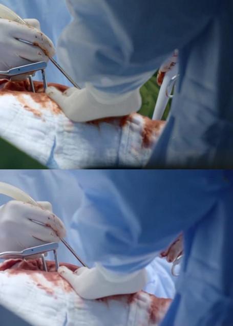 Những chi tiết sai cơ bản trong Hậu duệ mặt trời bản Việt-5