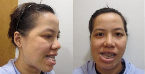 Cô giáo dạy thanh nhạc lột xác sau 27 năm chịu đắng cay vì mang gương mặt xấu ma chê quỷ hờn-1