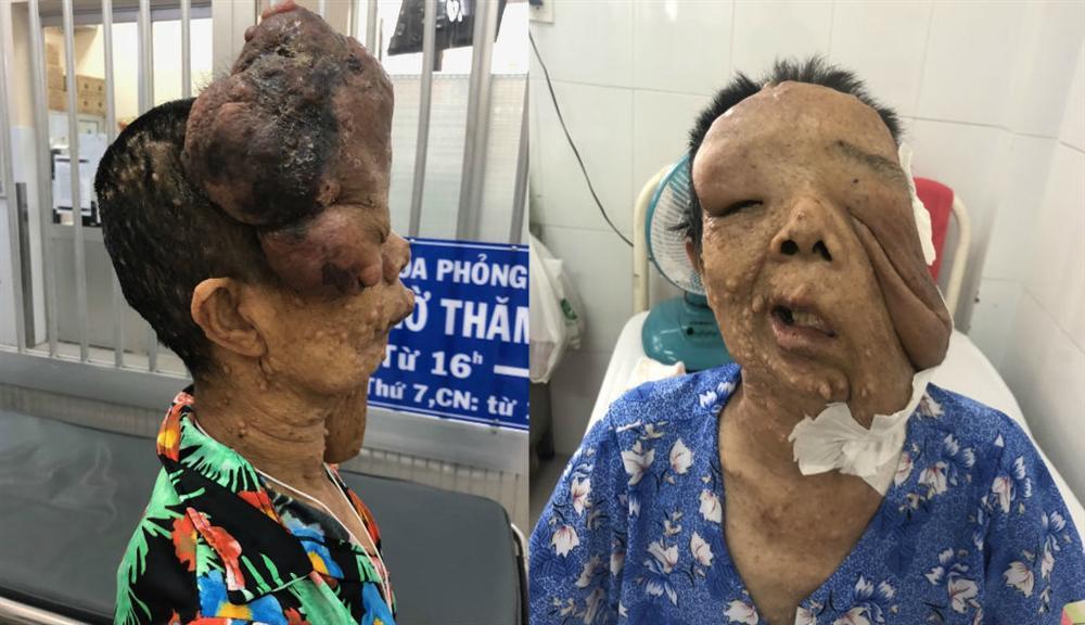 Người phụ nữ 10 năm không dám ra đường vì mang khuôn mặt kỳ dị-1