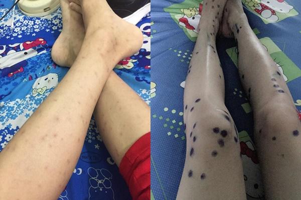 Bài học xương máu mà cháu ngoại quốc dân Nguyễn Ngọc Phú trước khi mất muốn gửi các bạn trẻ-2