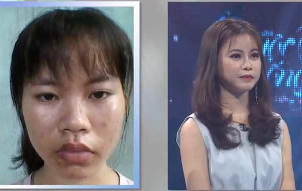 Cô sinh viên y khoa xấu xí trở nên xinh đẹp khiến mẹ không nhận ra-1