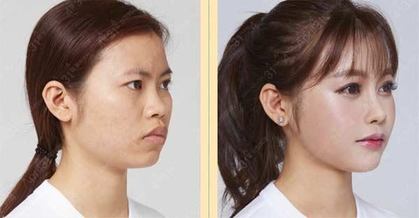 Cô sinh viên y khoa xấu xí trở nên xinh đẹp khiến mẹ không nhận ra-2