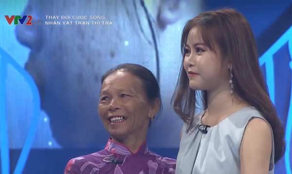 Cô sinh viên y khoa xấu xí trở nên xinh đẹp khiến mẹ không nhận ra-4