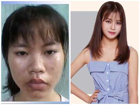 Cô sinh viên y khoa xấu xí trở nên xinh đẹp khiến mẹ không nhận ra