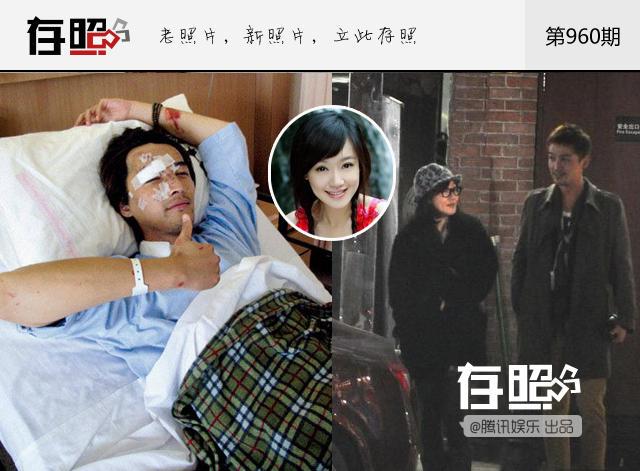 Tình cũ Hồ Ca gây sốc với khuôn mặt méo mó biến dạng do phẫu thuật thẩm mỹ-8