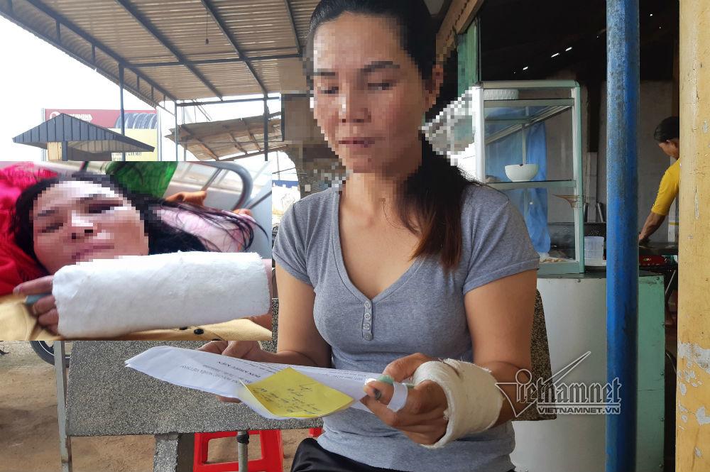 Đắk Nông: Tra tấn, thiêu sống người tình vì bị từ chối tình cảm-1