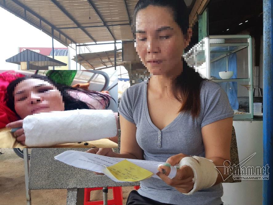 Tra tấn dã man người làm, Nga vọc lãnh án 10 năm tù-3