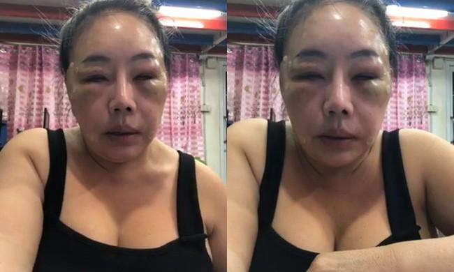 Từng gây xôn xao với mặt sưng phù nghi bị đánh, nữ đại gia U60 có khả năng yêu 28 lần/ngày tái xuất với nhan sắc như hoa hậu?-1