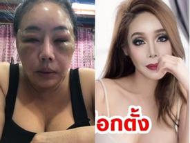 Từng gây xôn xao với mặt sưng phù nghi bị đánh, nữ đại gia U60 có khả năng 'yêu' 28 lần/ngày tái xuất với nhan sắc như hoa hậu? Từng gây xôn xao với mặt sưng phù nghi bị đánh, nữ đại gia U60 có khả năng 'yêu' 28 lần/ngày tái xuất với nhan sắc như hoa hậu?