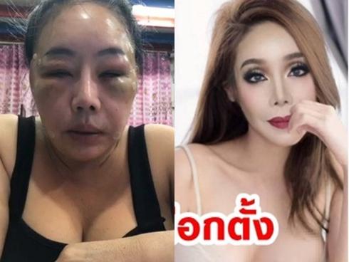 Từng gây xôn xao với mặt sưng phù nghi bị đánh, nữ đại gia U60 có khả năng 'yêu' 28 lần/ngày tái xuất với nhan sắc như hoa hậu?