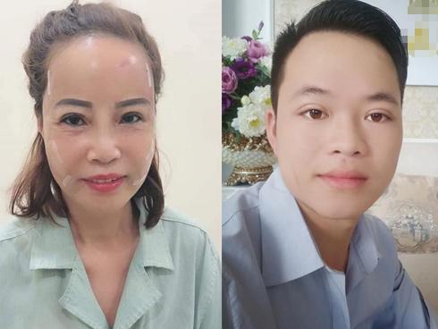 Bất chấp dao kéo mổ xẻ đau đớn, cô dâu 61 tuổi: Dù giảm thọ, tôi vẫn muốn xứng ngoại hình với chồng-3