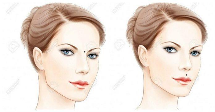 7 nốt ruồi khắc chồng khiến phụ nữ lận đận đường tình duyên-2