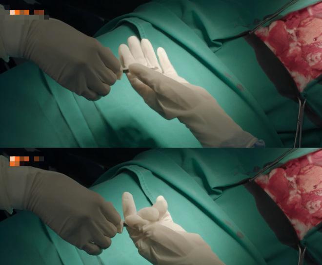 Hài hước cảnh dùng thịt bò để phẫu thuật trong Hậu duệ mặt trời bản Việt-8