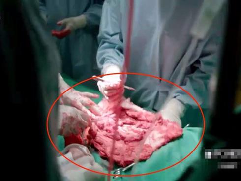 Hậu duệ mặt trời Việt Nam mắc sai lầm ngớ ngẩn: bệnh nhân mắc virus truyền nhiễm nguy hiểm, bác sĩ vô tư sờ tay khám chẳng sợ chết-7