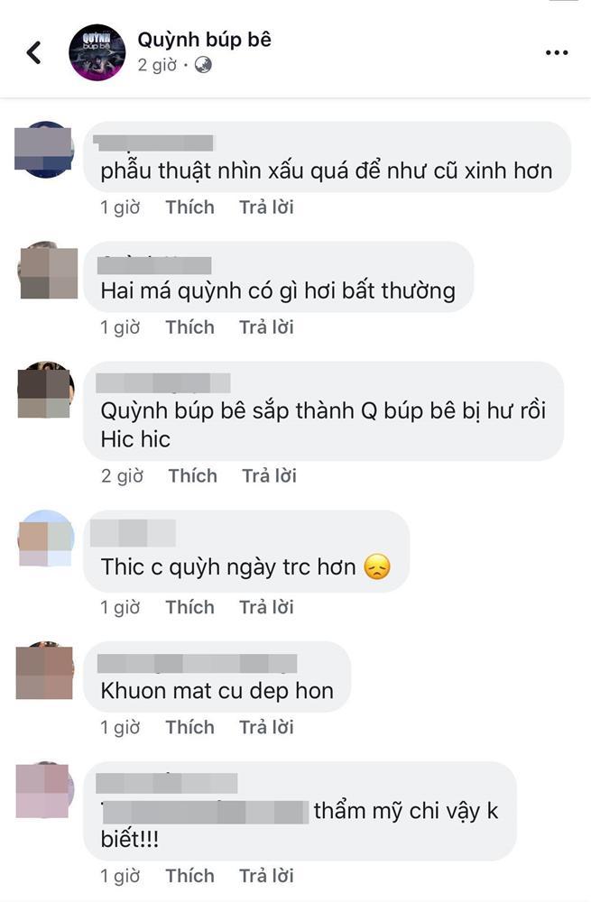 Phương Oanh Quỳnh Búp Bê gây tiếc nuối với khuôn mặt sau phẫu thuật như Búp Bê bị hư-7