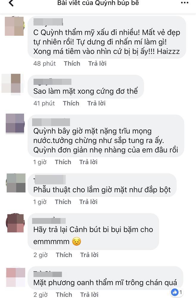 Phương Oanh Quỳnh Búp Bê gây tiếc nuối với khuôn mặt sau phẫu thuật như Búp Bê bị hư-8