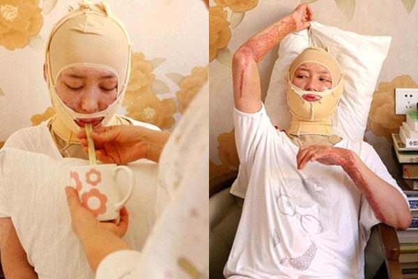 Cuộc sống của nữ sinh từng bị bạn trai thiếu gia tẩm xăng thiêu sống cách đây 7 năm hiện giờ ra sao?-2