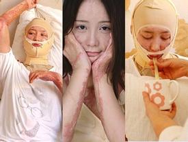 Cuộc sống của nữ sinh từng bị bạn trai thiếu gia tẩm xăng thiêu sống cách đây 7 năm hiện giờ ra sao? Cuộc sống của nữ sinh từng bị bạn trai thiếu gia tẩm xăng thiêu sống cách đây 7 năm hiện giờ ra sao?