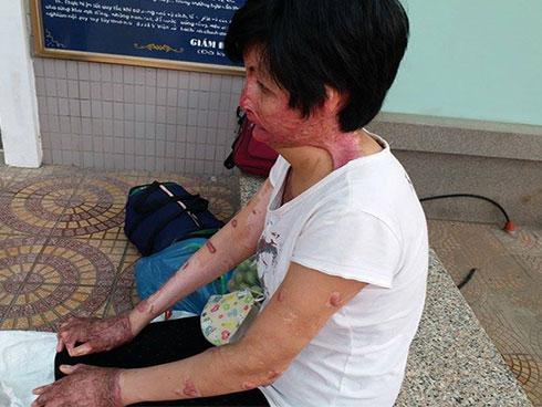 Cuộc sống của nữ sinh từng bị bạn trai thiếu gia tẩm xăng thiêu sống cách đây 7 năm hiện giờ ra sao?-9