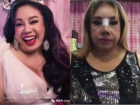 Nữ đại gia U60 yêu 28 lần/ngày gây thất vọng với nhan sắc sau 2 lần phẫu thuật thẩm mỹ-5