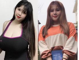 Hút mỡ rồi đến nâng mũi và đây là hình ảnh lột xác choáng váng người nhìn của nữ sinh 'ngực khủng' ở Hải Dương Hút mỡ rồi đến nâng mũi và đây là hình ảnh lột xác choáng váng người nhìn của nữ sinh 'ngực khủng' ở Hải Dương