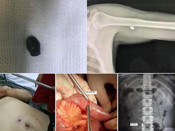 Xả súng hàng loạt vào quán bar ở California, nhiều người bị thương-2