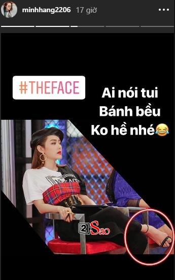 Đâu chỉ có Minh Hằng hay Ngọc Trinh, dàn mỹ nhân thế giới còn sở hữu đôi chân XẤU DỊ gấp nghìn lần-5