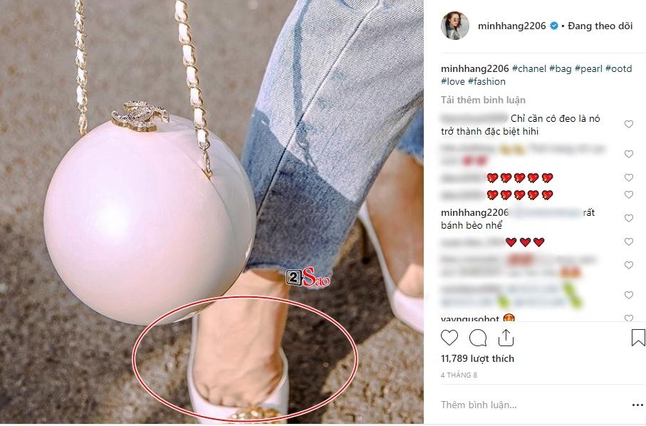 Minh Hằng khoe bàn chân xương xẩu bên chồng tương lai-4