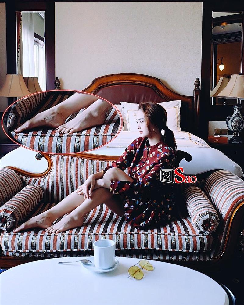 Minh Hằng khoe bàn chân xương xẩu bên chồng tương lai-6