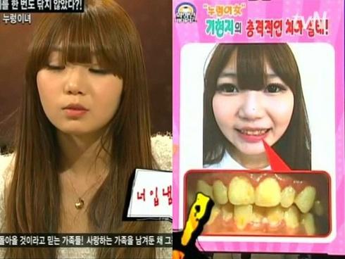 Cô gái trẻ gây sốc với thói quen 10 năm không đánh răng, thường ăn kẹo chung với chó