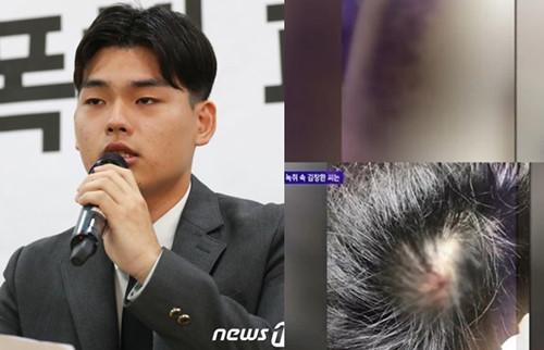 Nhóm nhạc Kpop đâm đơn kiện nhà sản xuất vì tội bạo hành-1