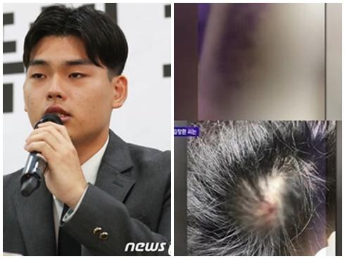 Nhóm nhạc Kpop đâm đơn kiện nhà sản xuất vì tội bạo hành