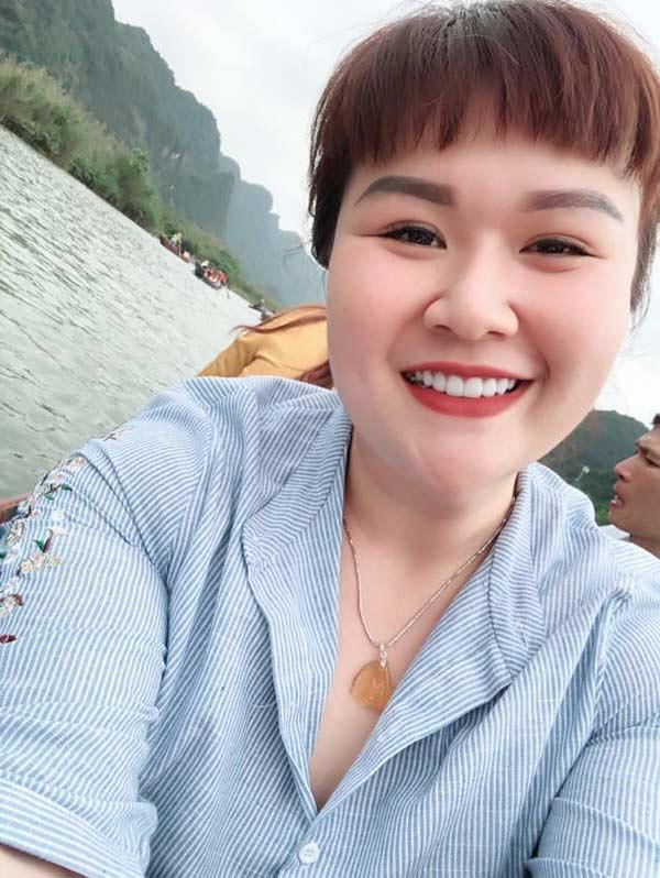 Nàng béo Thủy Tiên và cuộc sống thay đổi sau 2 lần đại phẫu hút mỡ-6