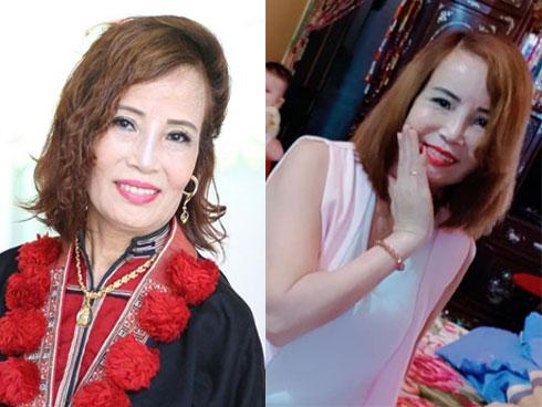 Lộ làn da xỉn, nhăn nheo của cô dâu 61 tuổi sau khi dao kéo khiến ai nấy giật mình vì tiếc tiền-8