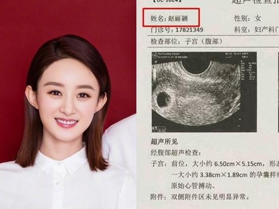 Triệu Lệ Dĩnh lộ giấy khám thai, vừa công khai kết hôn nhưng đã 'bầu bí' tới 6 tuần