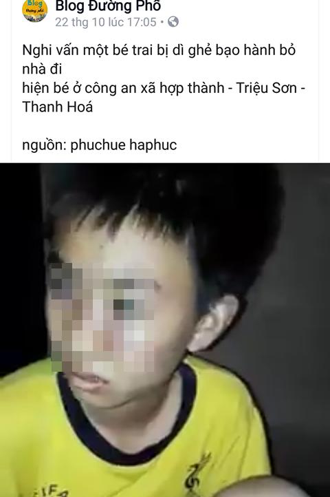 Bé trai bị bố đánh thâm tím, bỏ nhà đi lang thang-1