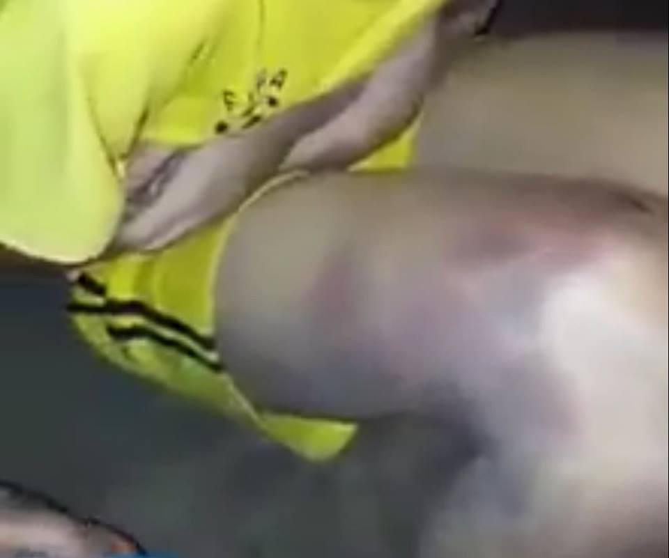 Bé trai bị bố đánh thâm tím, bỏ nhà đi lang thang-2