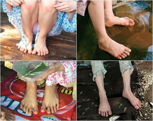 Đâu chỉ có Minh Hằng hay Ngọc Trinh, dàn mỹ nhân thế giới còn sở hữu đôi chân XẤU DỊ gấp nghìn lần-4