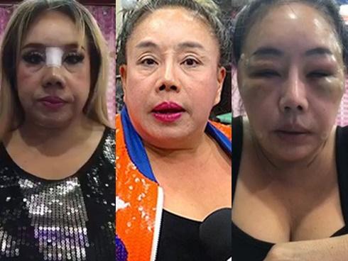 Nữ đại gia U60 'yêu' 28 lần/ngày gây thất vọng với nhan sắc sau 2 lần phẫu thuật thẩm mỹ