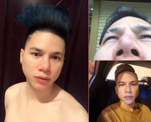 Lạm dụng phẫu thuật thẩm mỹ, loạt sao Việt xuất hiện với gương mặt biến chứng kinh hãi-6