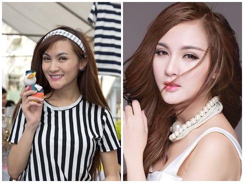 Lạm dụng phẫu thuật thẩm mỹ, loạt sao Việt xuất hiện với gương mặt biến chứng kinh hãi-11