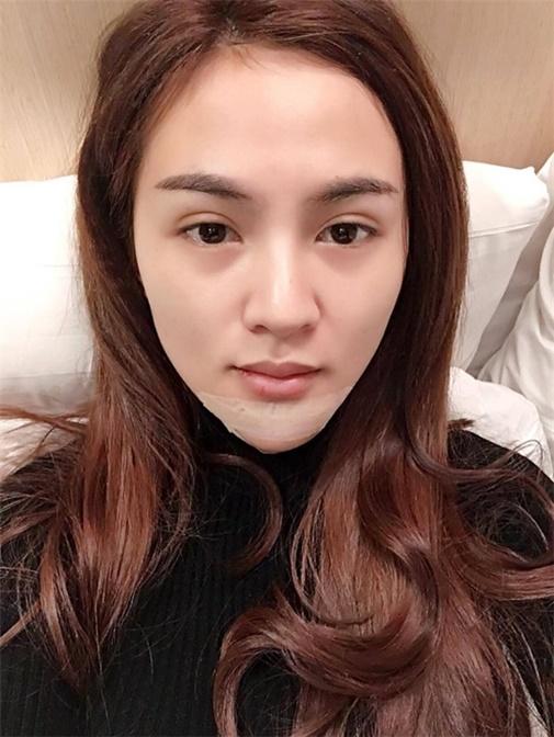 Lạm dụng phẫu thuật thẩm mỹ, loạt sao Việt xuất hiện với gương mặt biến chứng kinh hãi-10