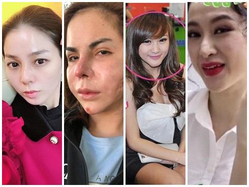 Góc cảnh báo: Cứ thích lăn kim, lột da nữa đi, bạn sẽ mất mặt như chơi đó!-7