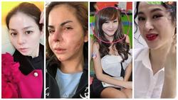 Lạm dụng phẫu thuật thẩm mỹ, loạt sao Việt xuất hiện với gương mặt biến chứng kinh hãi