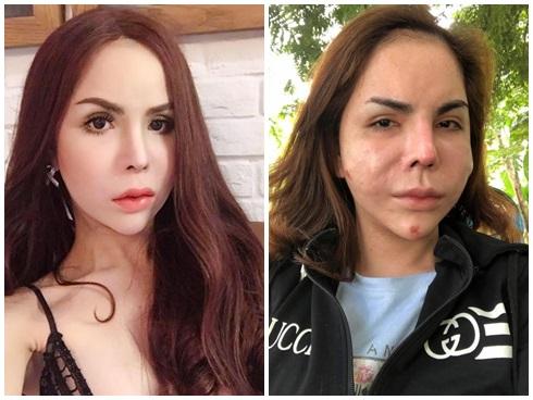 Lạm dụng phẫu thuật thẩm mỹ, loạt sao Việt xuất hiện với gương mặt biến chứng kinh hãi-13