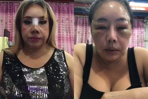 Nhan sắc gây thất vọng sau khi dao kéo, có ai ngờ ảnh thời trẻ của nữ đại gia U60 yêu 28 lần/ngày lại dễ mến đến thế-1