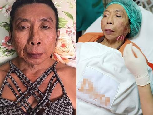 Tự sợ hãi với gương mặt xấu xí, gái già chuyển giới nổi tiếng thích cặp kè trai trẻ quyết 'đập mặt xây lại'