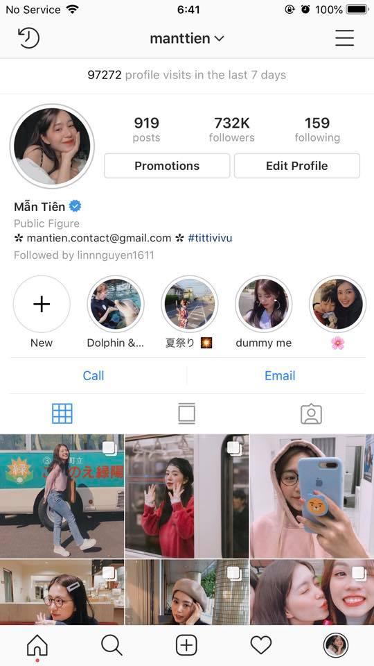 Khoe ảnh băng bó khi vừa thẩm mỹ, người hâm mộ khuyên hotgirl Kelly: Chị đẹp lắm rồi, đừng làm gì nữa-5